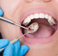 Our dentists in St Marys, NSW, bring decades of clinical expertise to the practice. We are passionate about helping patients achieve and maintain healthy, confident smiles. Our team is recognized for its calm and attentive nature. Dr Tran takes the time to build lasting relationships with patients, many of whom have trusted him with their family’s dental care for generations. This long-term approach to dentistry ensures that patients receive excellent treatment and benefit from continuity of care, as well as a comprehensive understanding of their dental history and individual needs.