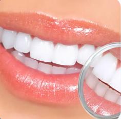 Enhance the appearance of your teeth for a cleaner, brighter result. Recognised in Penrith for effective teeth whitening, our cosmetic dentists use advanced techniques to lift stains and improve your dental aesthetics. We customise each treatment to suit the condition of your enamel. Whether you’re considering an in-chair session or take-home trays, our team explains every step clearly so you know exactly what to expect. We keep the process straightforward and comfortable, helping you feel informed and at ease throughout your treatment.