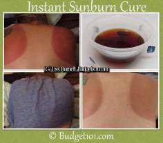 Instant Sunburn Relief Cure- how to fix a painful sunburn and turn it into a painless tan with this tried and true trick. Brew 5-6 bags of earl grey tea and soak a towel in it. Apply towel to sunburn for at least 30 minutes.