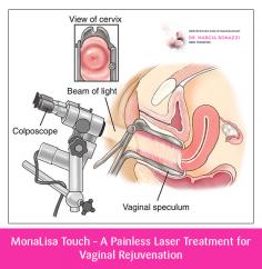 When it comes to getting MonaLisa Touch laser treatment, Melbourne women prefer to choose Dr. Marcia Bonazzi. Our treatment is designed to regenerate the vaginal tissues and restore the blood supply. 